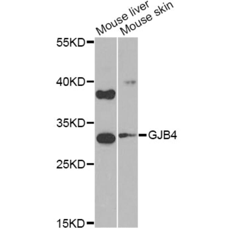 Western Blot - Anti-GJB4 Antibody (A9888) - Antibodies.com
