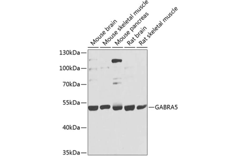 Western Blot - Anti-GABA A Receptor alpha 5/GABRA5 Antibody (A17264) - Antibodies.com