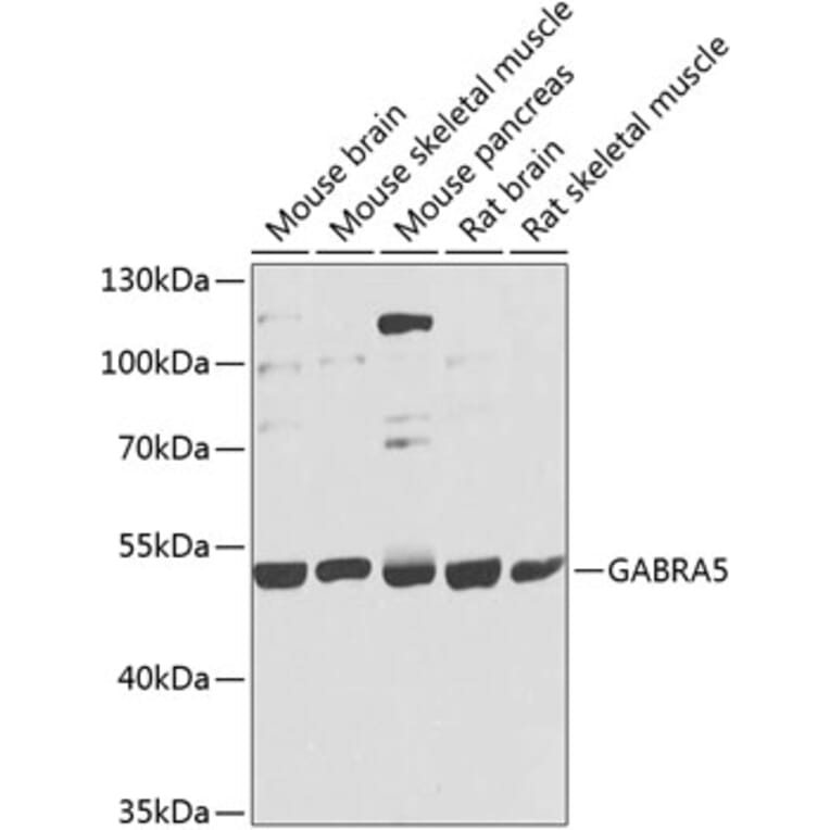 Western Blot - Anti-GABA A Receptor alpha 5/GABRA5 Antibody (A17264) - Antibodies.com