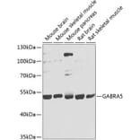 Western Blot - Anti-GABA A Receptor alpha 5/GABRA5 Antibody (A17264) - Antibodies.com