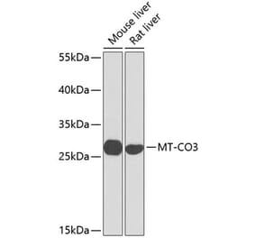 Western Blot - Anti-MT-CO3 Antibody (A17265) - Antibodies.com