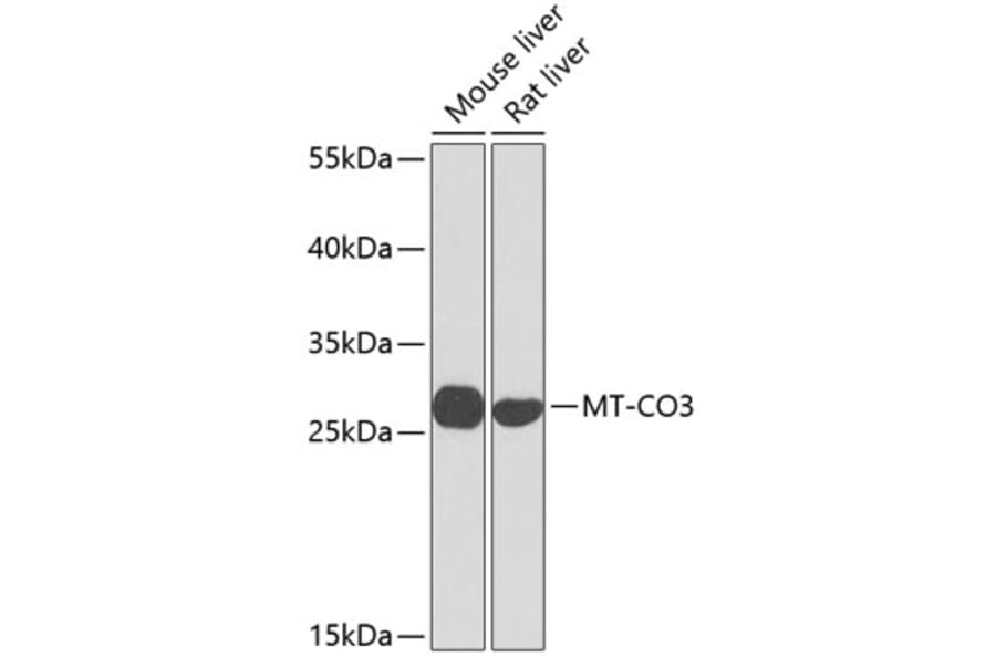 Western Blot - Anti-MT-CO3 Antibody (A17265) - Antibodies.com