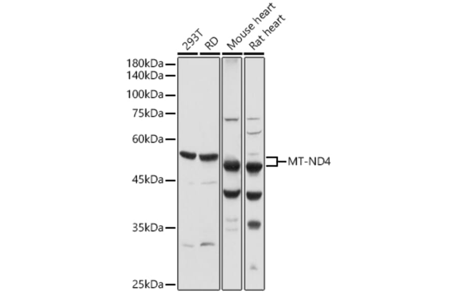 Western Blot - Anti-ND4 Antibody (A17266) - Antibodies.com