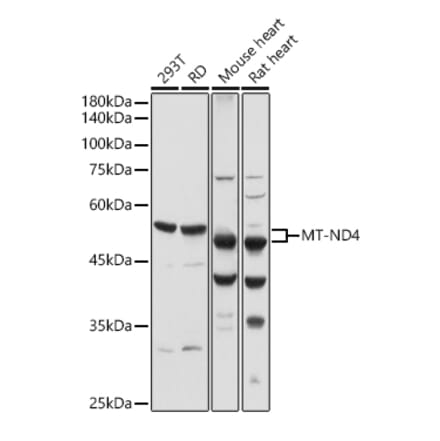 Western Blot - Anti-ND4 Antibody (A17266) - Antibodies.com