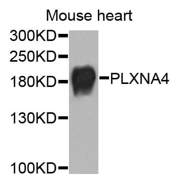 Anti-PLXNA4 Antibody (A17267) | Antibodies.com