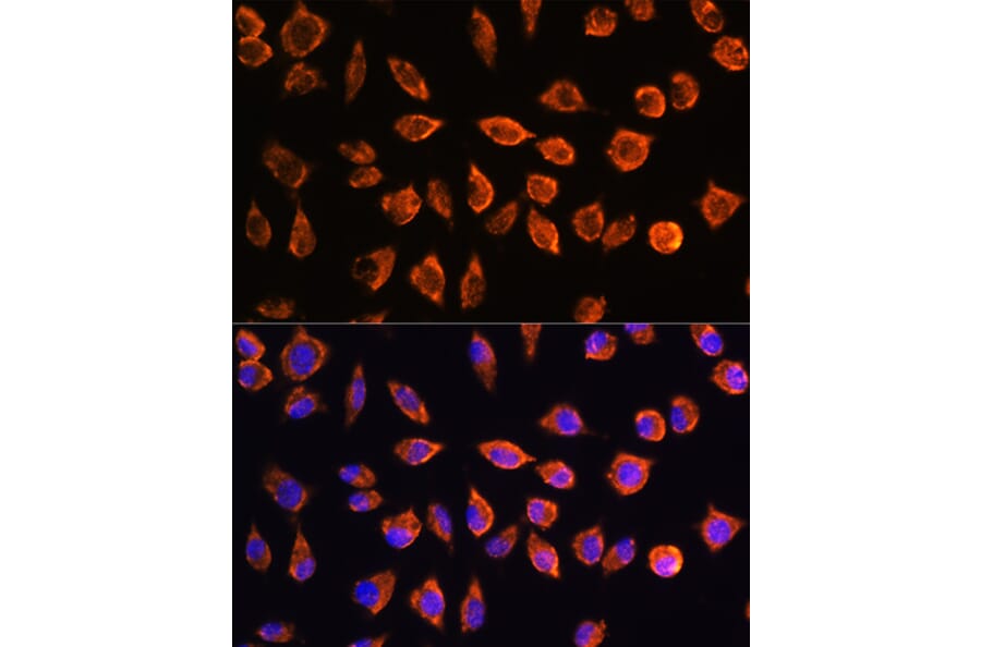 Immunofluorescence - Anti-NOTCH3 Antibody (A17270) - Antibodies.com