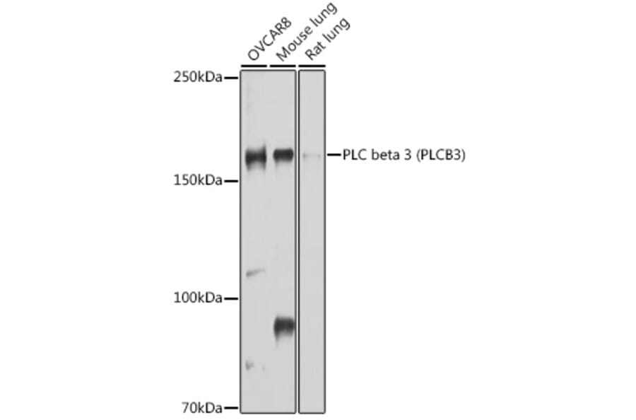 Western Blot - Anti-Phospholipase C beta 3/PLCB3 Antibody (A17274) - Antibodies.com