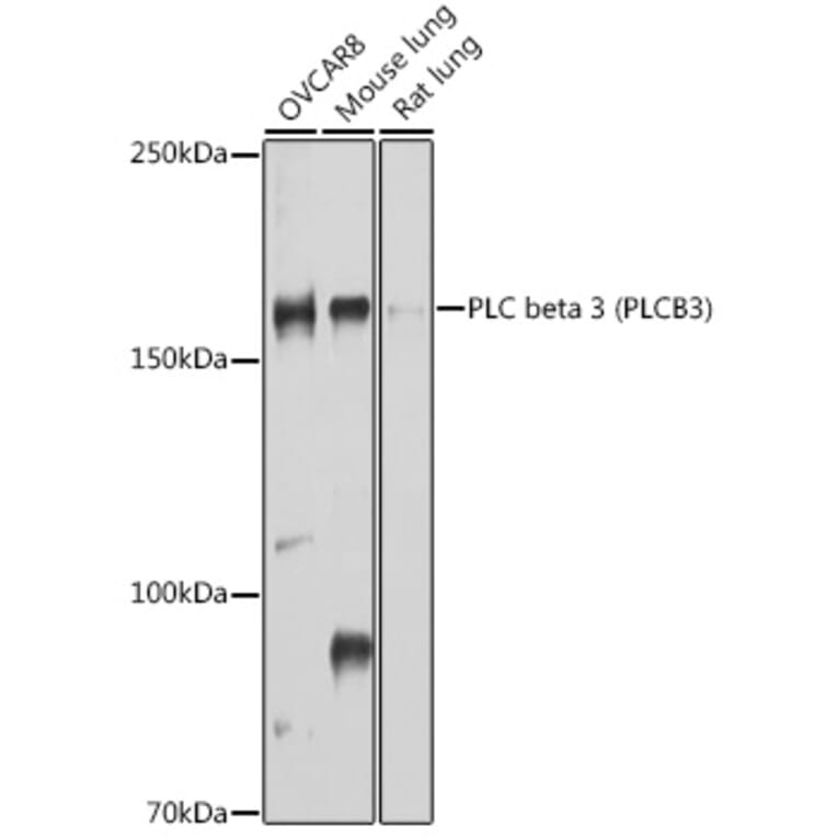 Western Blot - Anti-Phospholipase C beta 3/PLCB3 Antibody (A17274) - Antibodies.com