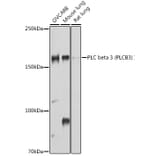 Western Blot - Anti-Phospholipase C beta 3/PLCB3 Antibody (A17274) - Antibodies.com