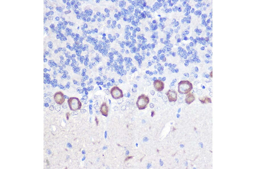 Immunohistochemistry - Anti-Phospholipase C beta 3/PLCB3 Antibody (A17274) - Antibodies.com
