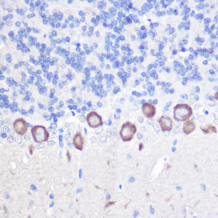 Immunohistochemistry - Anti-Phospholipase C beta 3/PLCB3 Antibody (A17274) - Antibodies.com