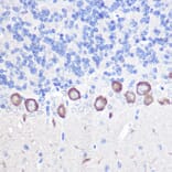 Immunohistochemistry - Anti-Phospholipase C beta 3/PLCB3 Antibody (A17274) - Antibodies.com
