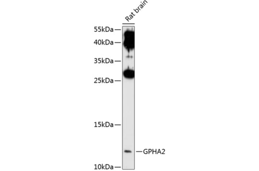Western Blot - Anti-GPHA2 Antibody (A17277) - Antibodies.com