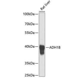 Western Blot - Anti-ADH1B Antibody (A17279) - Antibodies.com