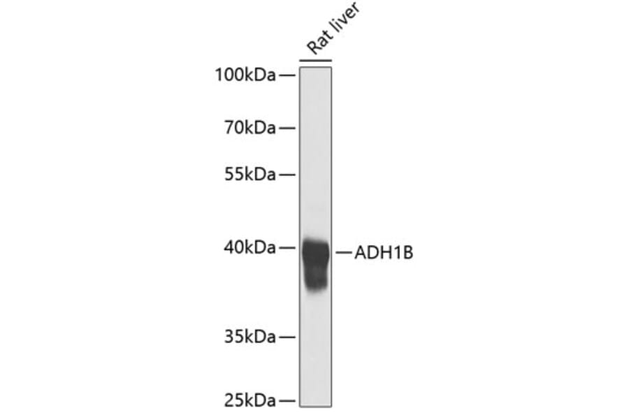 Western Blot - Anti-ADH1B Antibody (A17279) - Antibodies.com