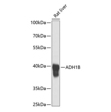 Western Blot - Anti-ADH1B Antibody (A17279) - Antibodies.com