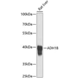 Western Blot - Anti-ADH1B Antibody (A17279) - Antibodies.com