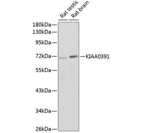 Western Blot - Anti-MRPP3 Antibody (A17282) - Antibodies.com