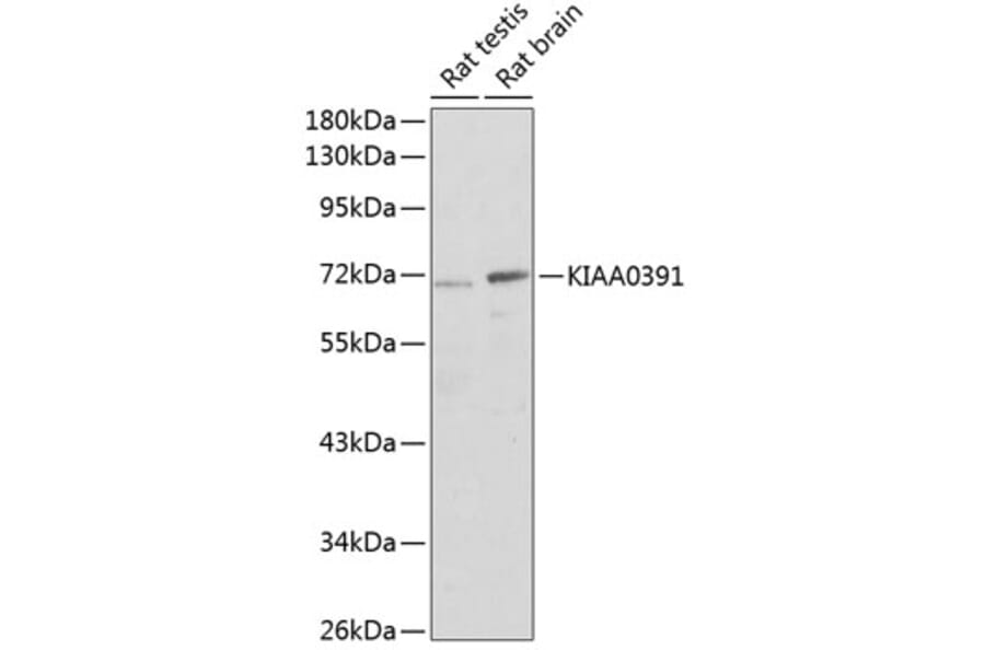 Western Blot - Anti-MRPP3 Antibody (A17282) - Antibodies.com