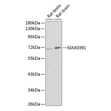 Western Blot - Anti-MRPP3 Antibody (A17282) - Antibodies.com