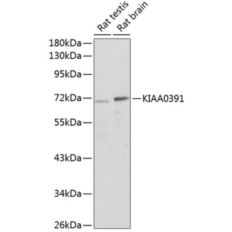 Western Blot - Anti-MRPP3 Antibody (A17282) - Antibodies.com