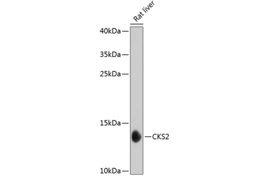 Western Blot - Anti-CKS2 Antibody (A17285) - Antibodies.com