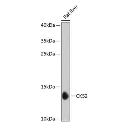 Western Blot - Anti-CKS2 Antibody (A17285) - Antibodies.com