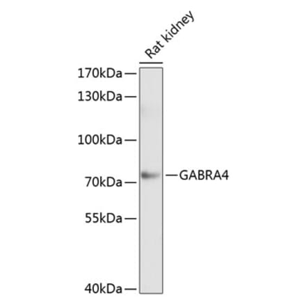 Western Blot - Anti-GABRA4 Antibody (A17286) - Antibodies.com