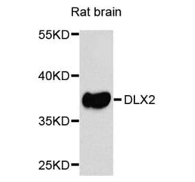 Western Blot - Anti-DLX2 Antibody (A8410) - Antibodies.com