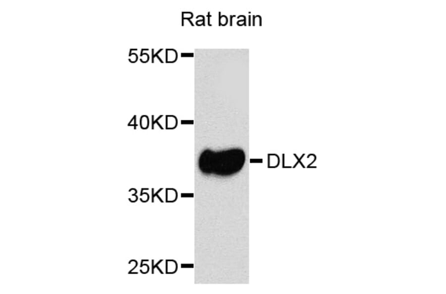 Western Blot - Anti-DLX2 Antibody (A8410) - Antibodies.com