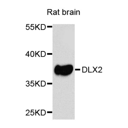 Western Blot - Anti-DLX2 Antibody (A8410) - Antibodies.com