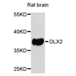 Western Blot - Anti-DLX2 Antibody (A8410) - Antibodies.com