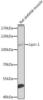 Western blot analysis of extracts of rat skeletal muscle, using Anti-LPIN1 Antibody (A8486) at 1:1,000 dilution.
Secondary antibody: Goat Anti-Rabbit IgG (H+L) (HRP) (AS014) at 1:10,000 dilution.
Lysates / proteins: 25µg per lane.
Blocking buffer: 3% non-fat dry milk in TBST.
Detection: ECL Basic Kit (RM00020).
Exposure time: 90s.