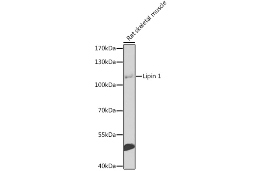 Western Blot - Anti-Lipin 1 Antibody (A17291) - Antibodies.com