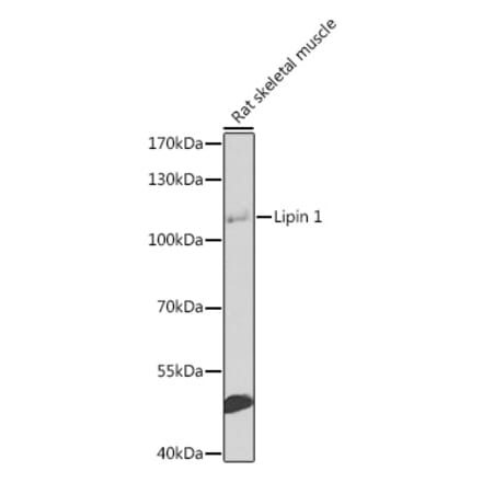 Western Blot - Anti-Lipin 1 Antibody (A17291) - Antibodies.com