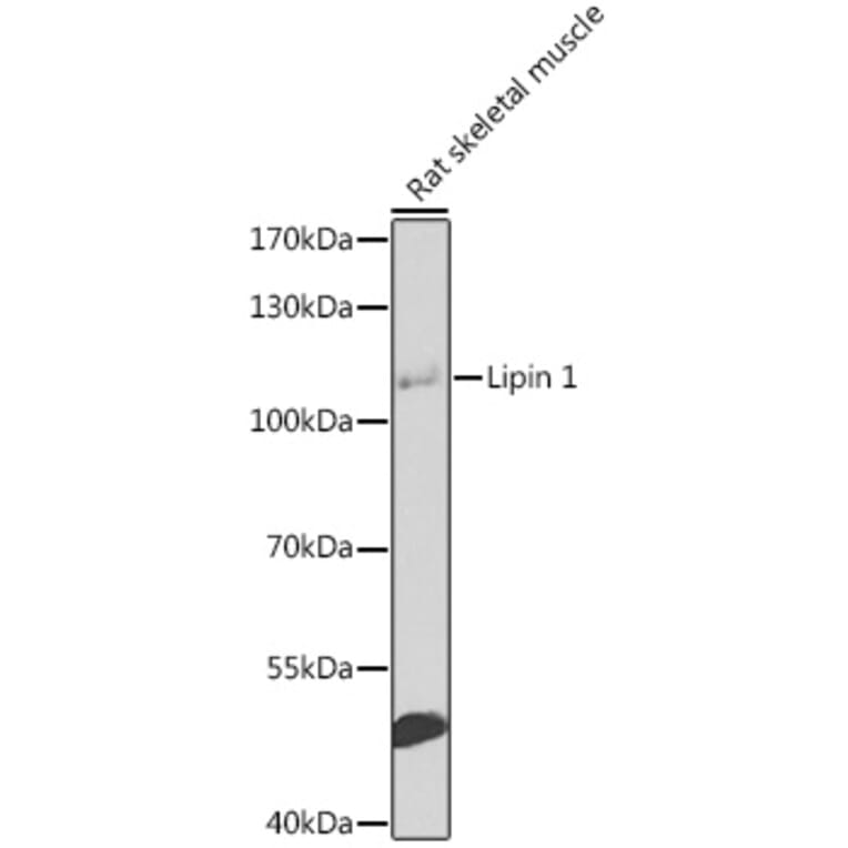 Western Blot - Anti-Lipin 1 Antibody (A17291) - Antibodies.com