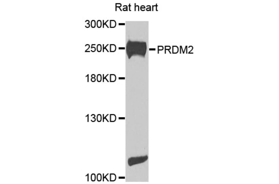 Western Blot - Anti-PRDM2 Antibody (A8565) - Antibodies.com