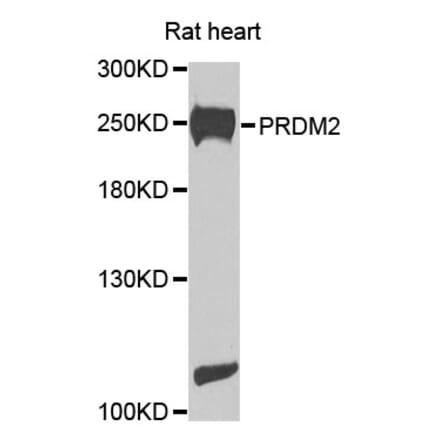 Western Blot - Anti-PRDM2 Antibody (A8565) - Antibodies.com