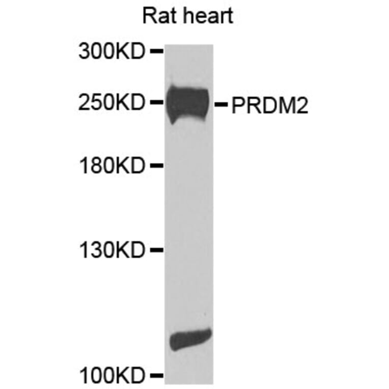 Western Blot - Anti-PRDM2 Antibody (A8565) - Antibodies.com