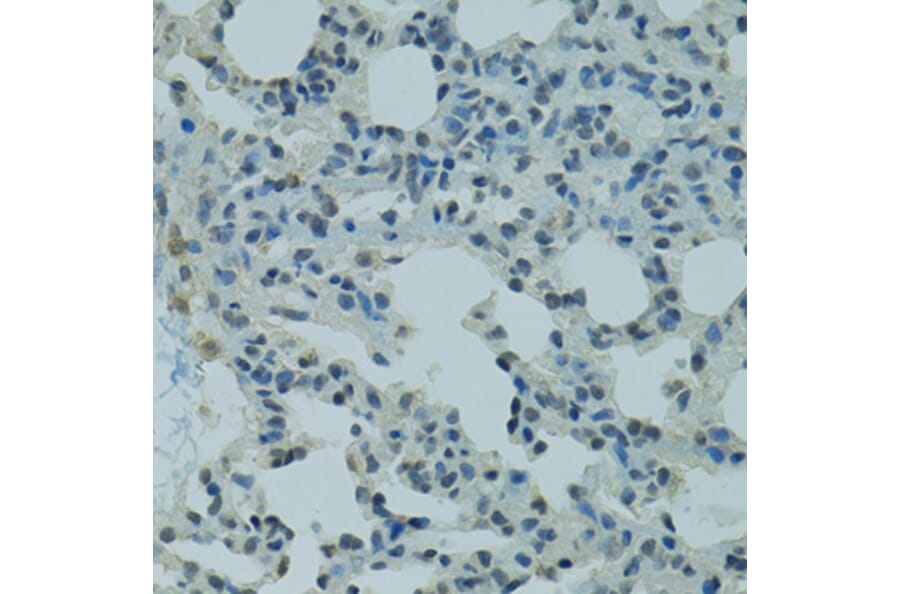 Immunohistochemistry - Anti-PRDM2 Antibody (A8565) - Antibodies.com