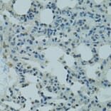 Immunohistochemistry - Anti-PRDM2 Antibody (A8565) - Antibodies.com