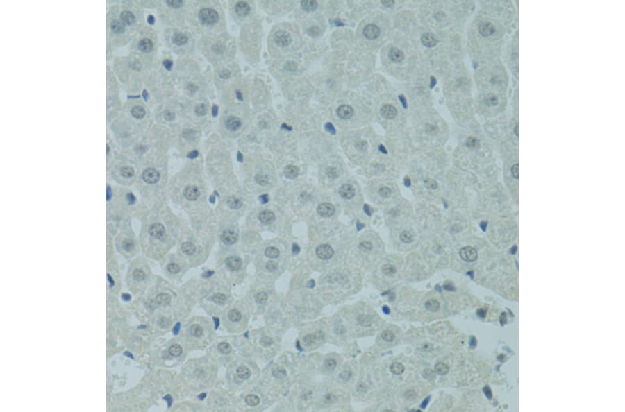 Immunohistochemistry - Anti-PRDM2 Antibody (A8565) - Antibodies.com