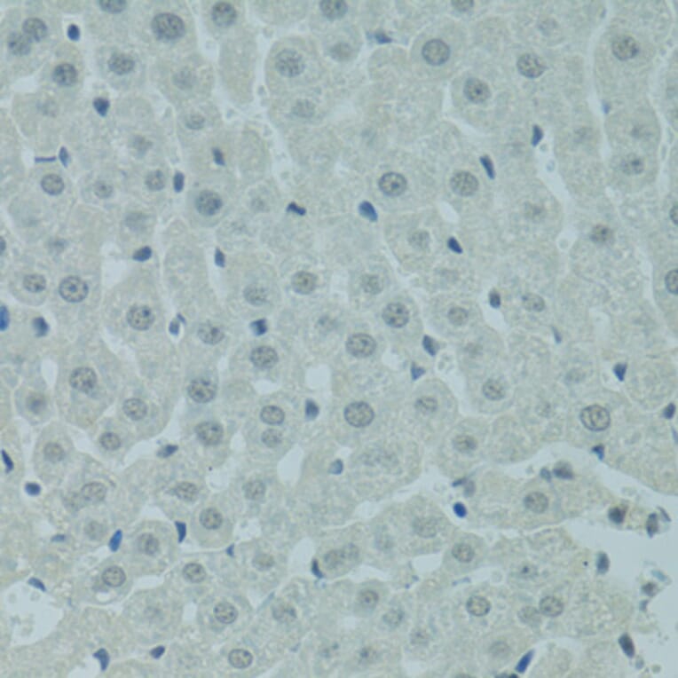 Immunohistochemistry - Anti-PRDM2 Antibody (A8565) - Antibodies.com