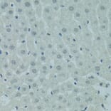 Immunohistochemistry - Anti-PRDM2 Antibody (A8565) - Antibodies.com