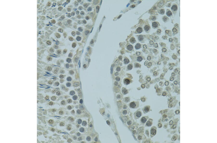 Immunohistochemistry - Anti-PRDM2 Antibody (A8565) - Antibodies.com