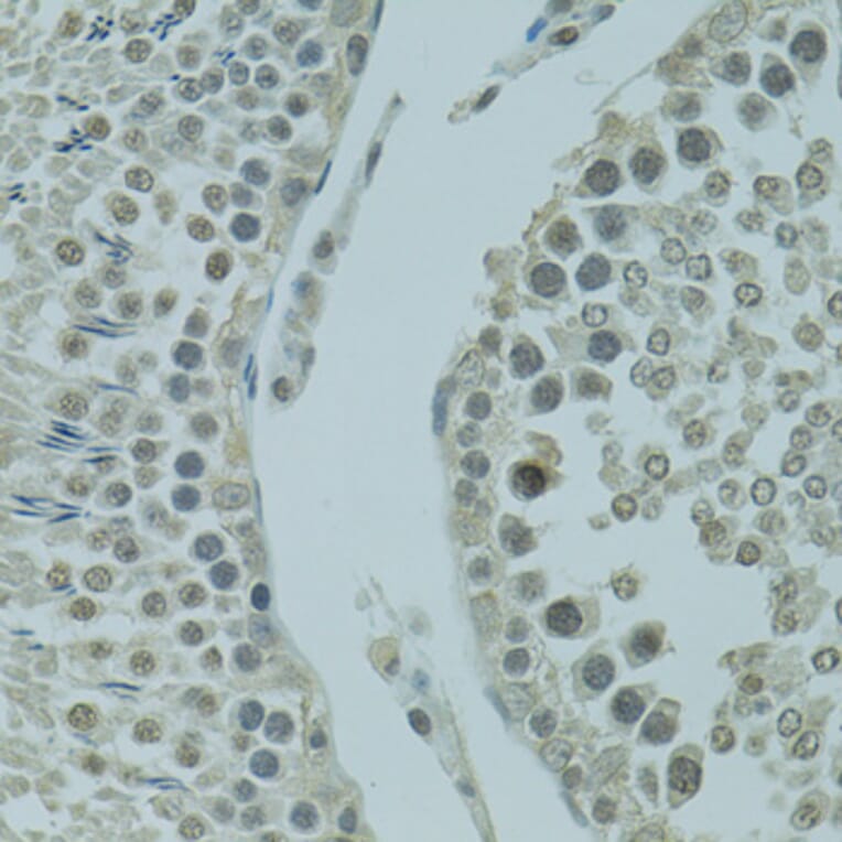 Immunohistochemistry - Anti-PRDM2 Antibody (A8565) - Antibodies.com