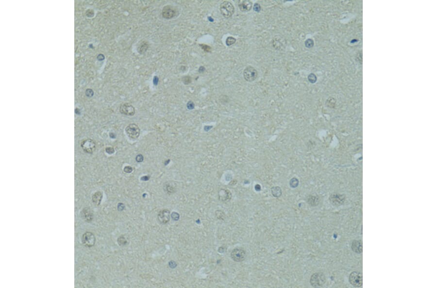 Immunohistochemistry - Anti-PRDM2 Antibody (A8565) - Antibodies.com
