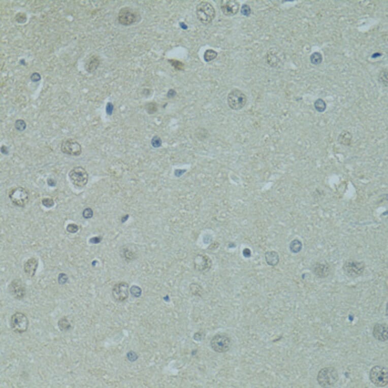 Immunohistochemistry - Anti-PRDM2 Antibody (A8565) - Antibodies.com