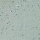 Immunohistochemistry - Anti-PRDM2 Antibody (A8565) - Antibodies.com