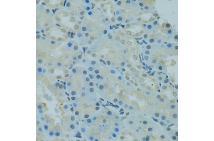 Immunohistochemistry - Anti-PRDM2 Antibody (A8565) - Antibodies.com